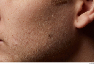 HD Face skin references Ethan Read cheek skin pores skin…